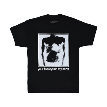 AORTA TEE